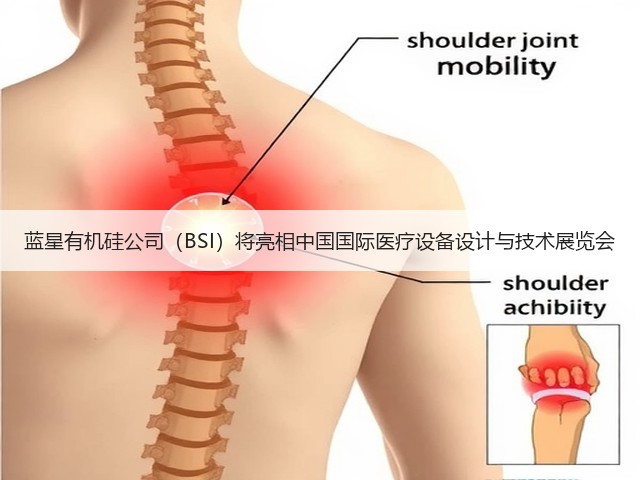蓝星有机硅公司(BSI)将亮相中国国际医疗设备设计与技术展览会 蓝星有机硅公司(BSI)将亮相中国国际医疗设备设计与技术展览会